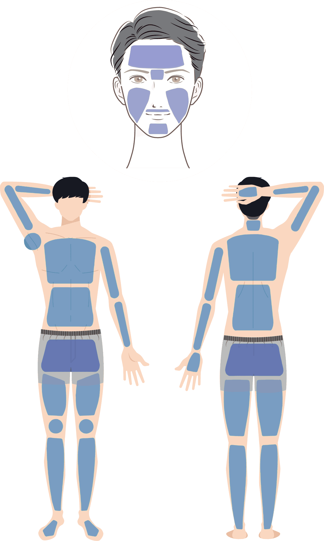 男性全身脱毛スタンダードセット（メンズ脱毛）