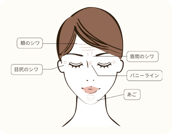 シワ