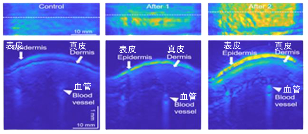 CO₂導入による血流促進イメージ